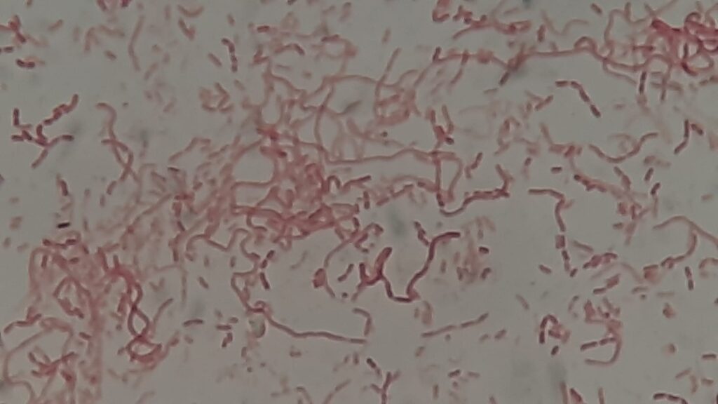 Acinetobacter ursingii in Gram staining of culture