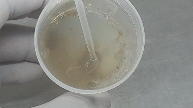 Fungal Culture of Clinical Samples: Introduction, Principle, Clinical