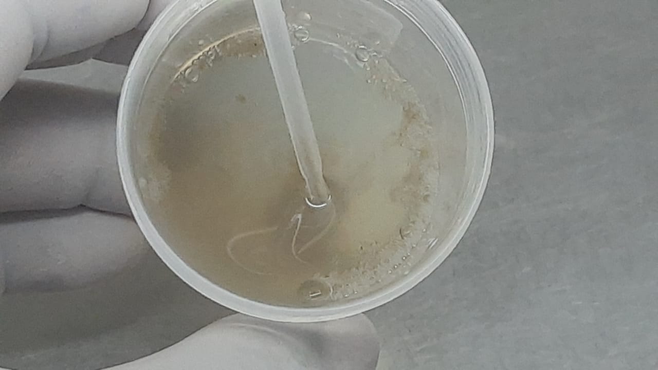 Fungal Culture of Clinical Samples: Introduction, Principle, Clinical
