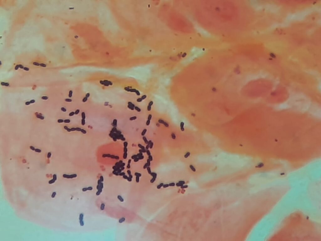 Bacteria in throat swab Gram stain photomicrograph at a magnification of 4000X