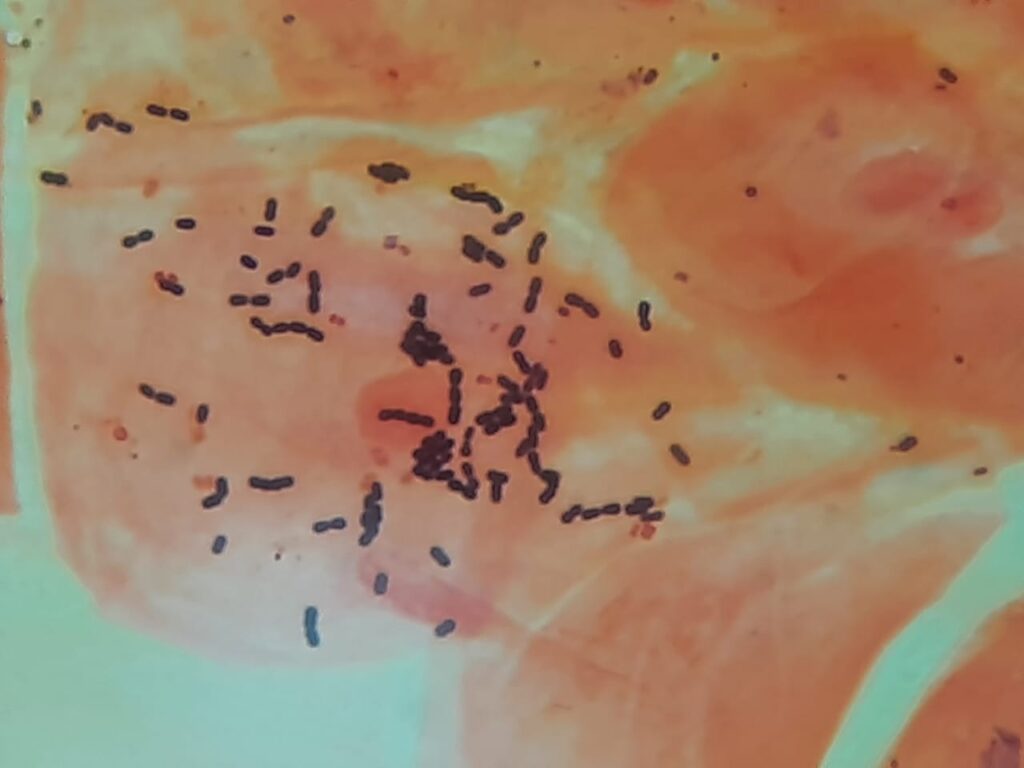 Gram positive and Gram negative bacteria in throat swab Gram stain photomicrograph at a magnification of 4000X