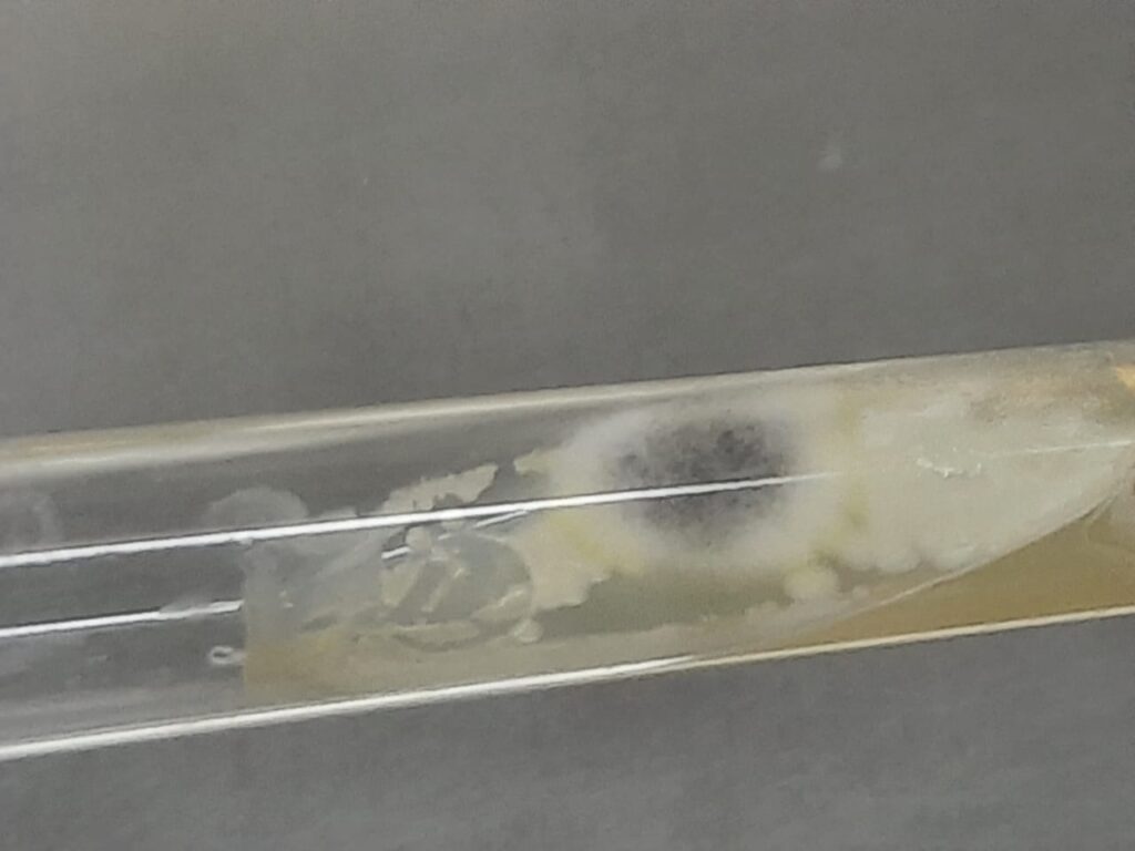 Yeast and mold growth on SDA agar