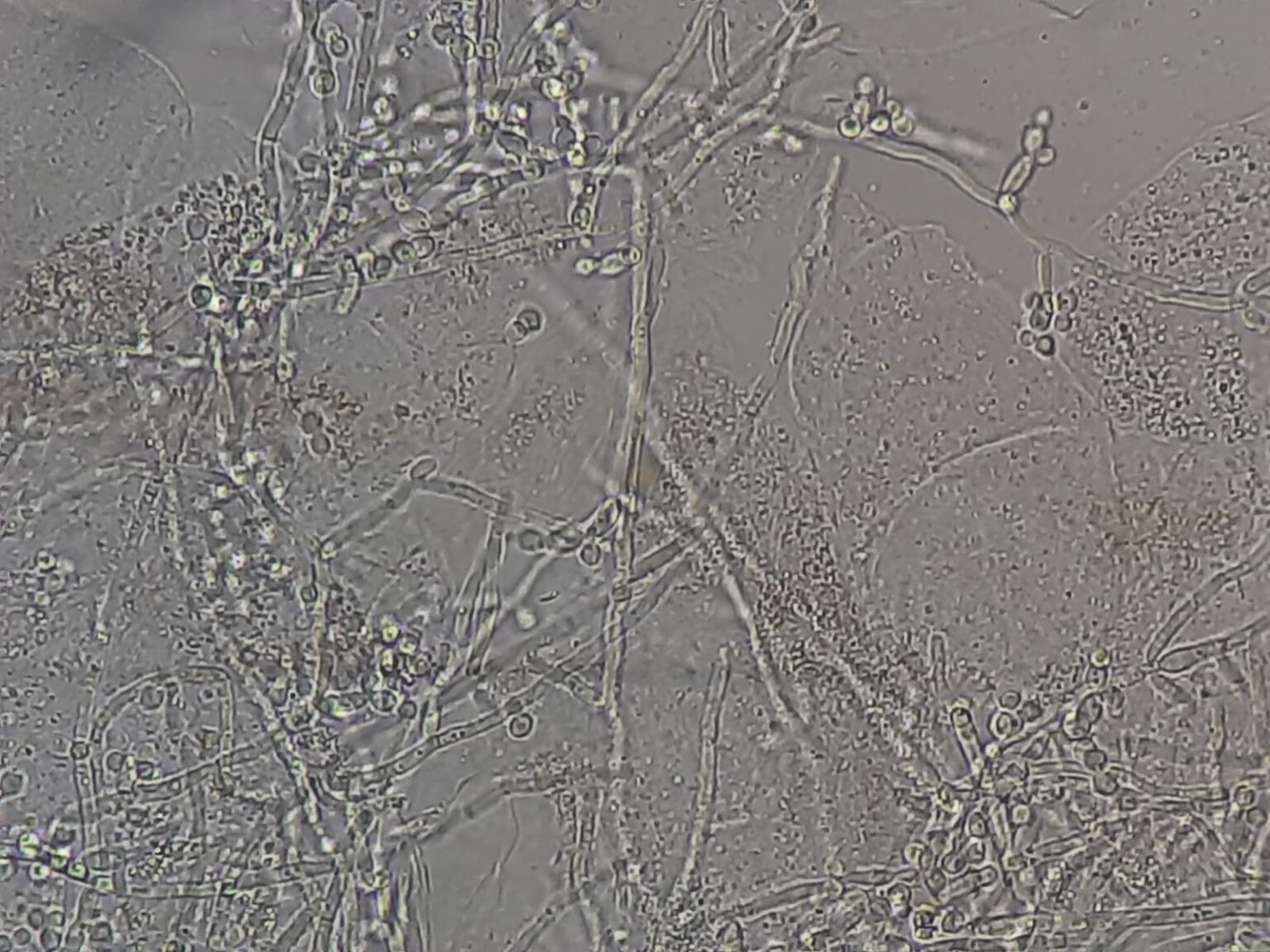 Direct Microscopy-KOH Smear: Introduction, Uses, and Keynotes