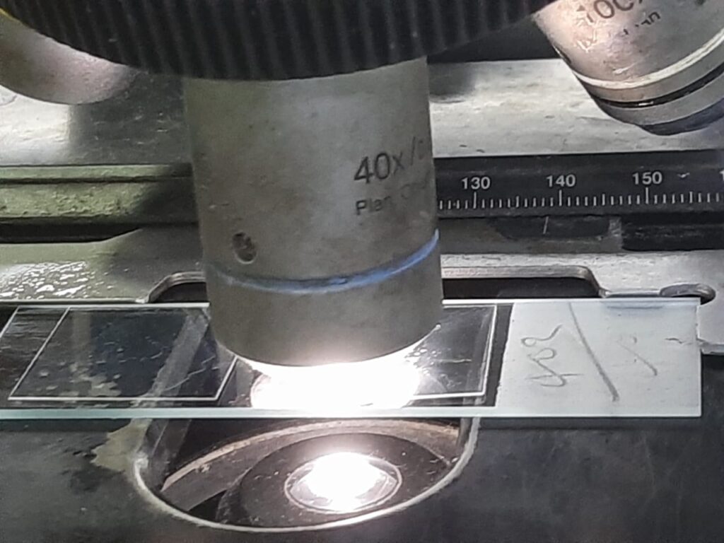 Fungal Elements in KOH Mount of BAL (Bronchoalveolar Lavage) Microscopy- Introduction, Fungal Elements Observed in Urine KOH Mount, Applications, and Keynotes