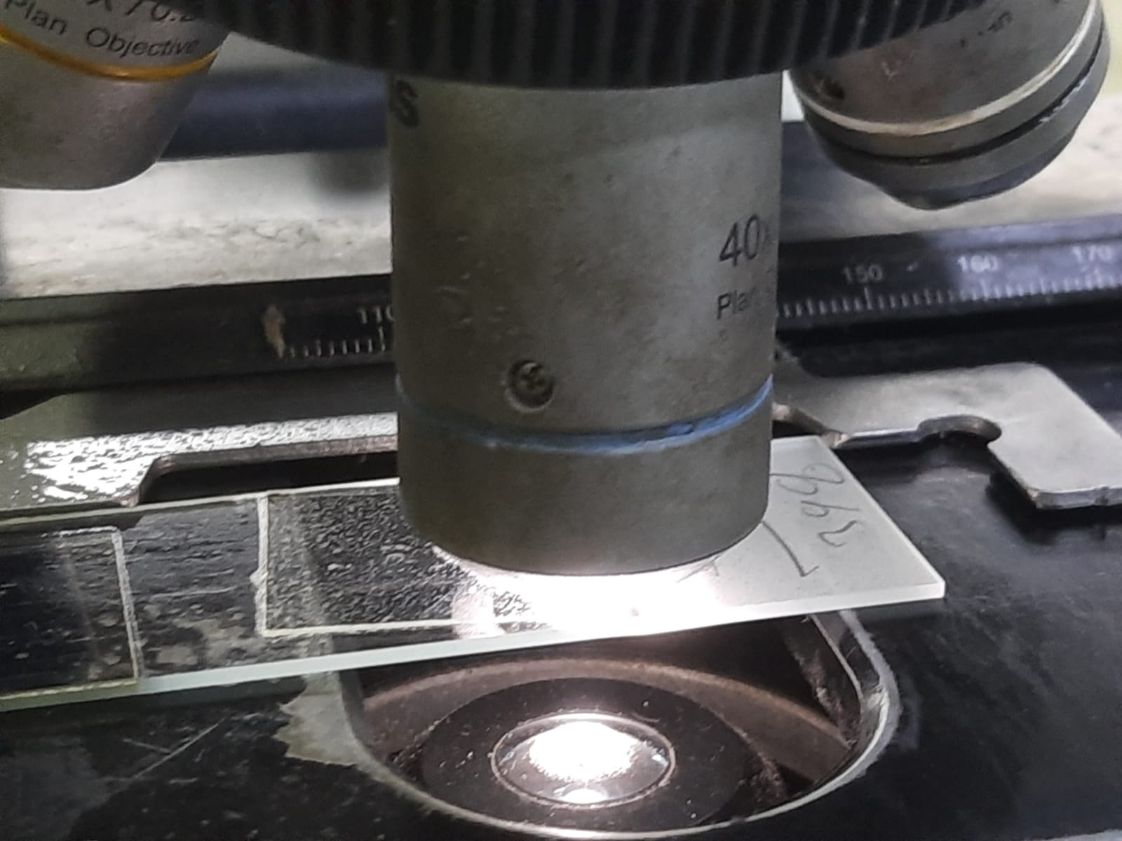 Fungal elements in KOH Mount of Urine Microscopy- Introduction, Fungal Elements Observed in Urine KOH Mount, Applications, and Keynotes