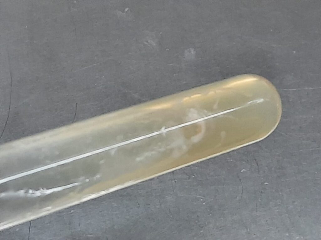 Fungal growth on Sabouraud dextrose agar after 2 days of incubation at 37C