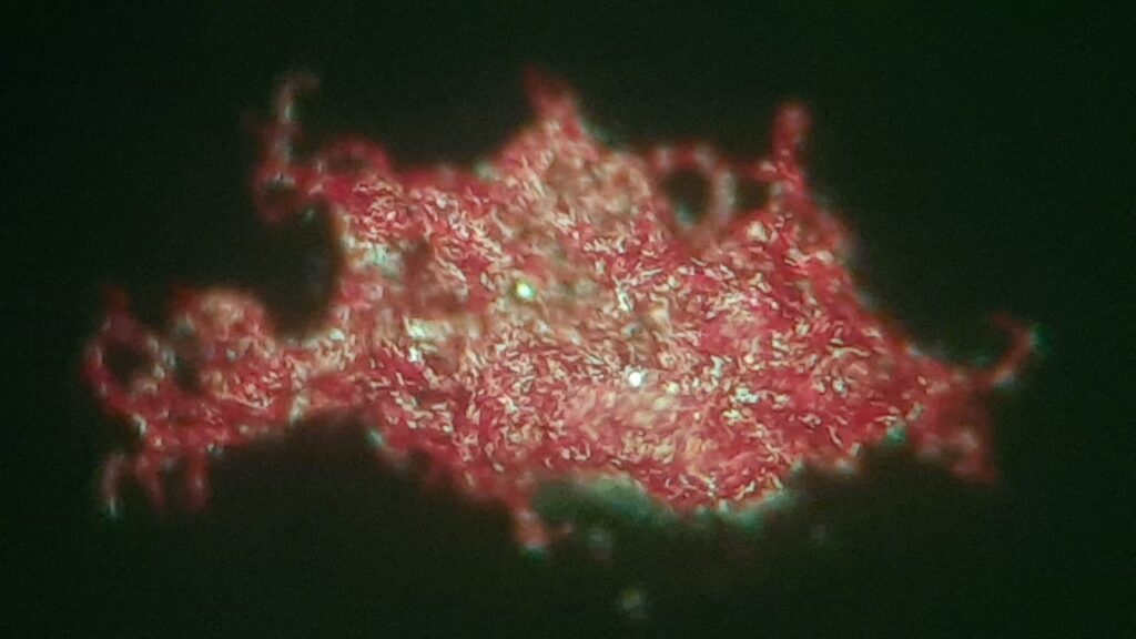 Cord factor or Trehalose dimycolate, TDM of Mycobacterium tuberculosis complex (MTBC) in Auramine-Rhodamine Fluorochrome stained smear microscopy of modified Middlebrook 7H9 Broth