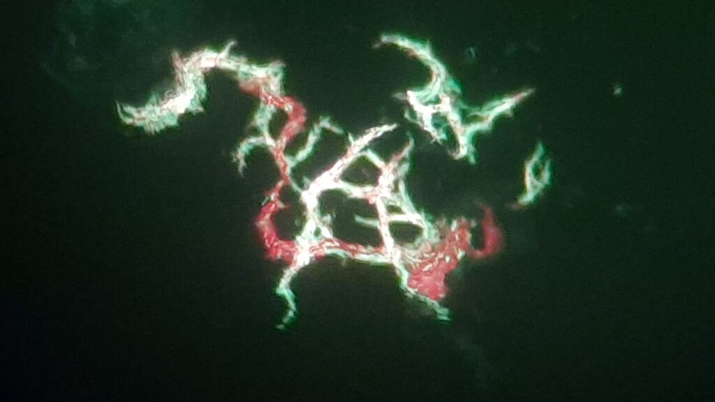 Cord factor or Trehalose dimycolate, TDM of Mycobacterium tuberculosis complex (MTBC) in Auramine-Rhodamine stained smear microscopy of liquid culture (Middlebrook medium)