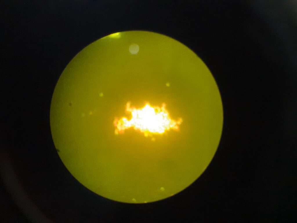 Cord factor or Trehalose dimycolate (TDM) of Mycobacterium tuberculosis complex (MTBC) in Auramine- Rhodamine staining of modified Middlebrook 7H9 Broth at a magnification of 400X
