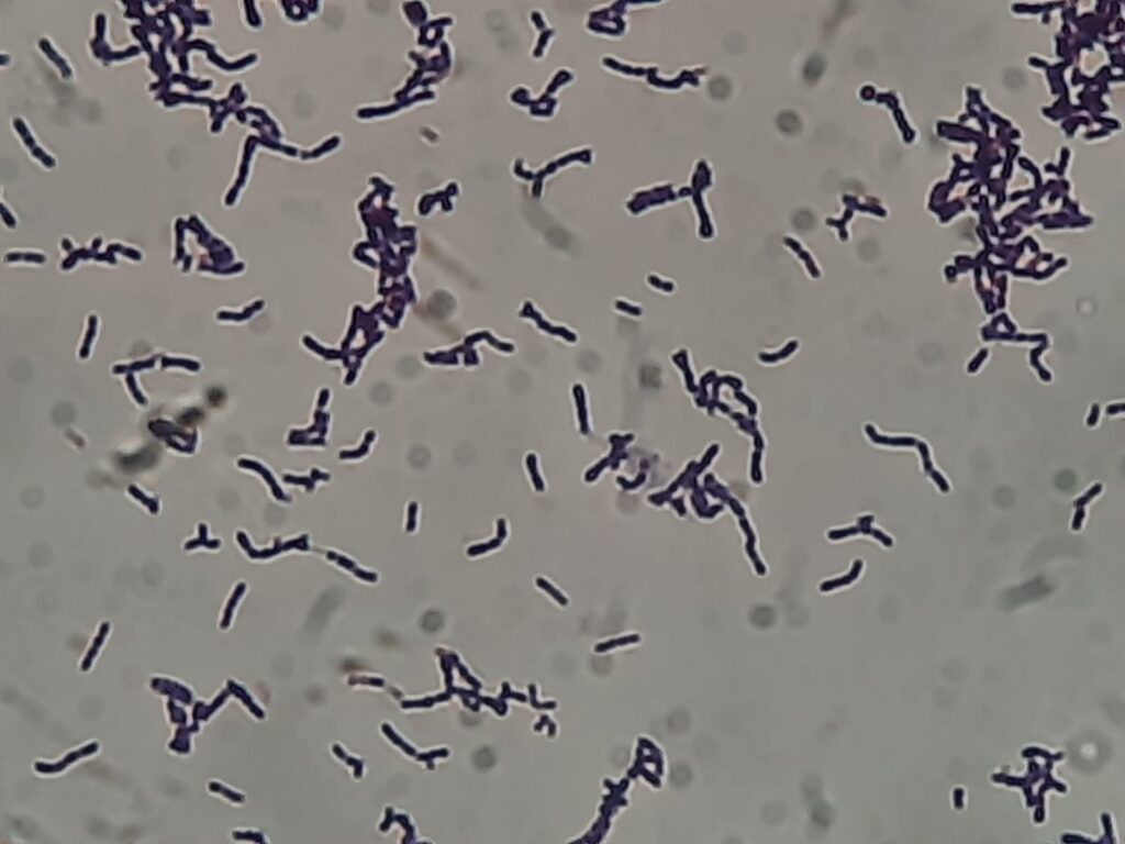 R. kristinae in Gram-stained culture microscopy shows irregular, pleomorphic Gram-positive bacilli, ranging from short rods to e