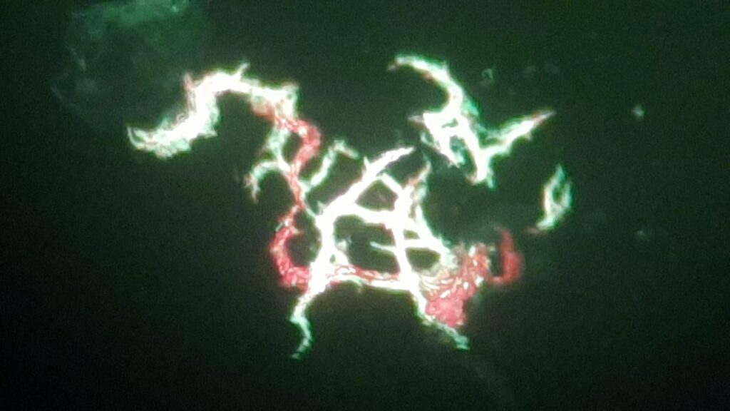Serpentine cord of Mycobacterium tuberculosis (MTB) in liquid culture (Middlebrook medium)