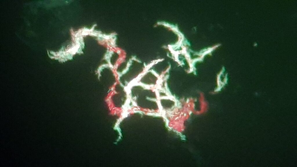 Serpentine cord of Mycobacterium tuberculosis complex (MTBC) in liquid culture (Middlebrook medium)