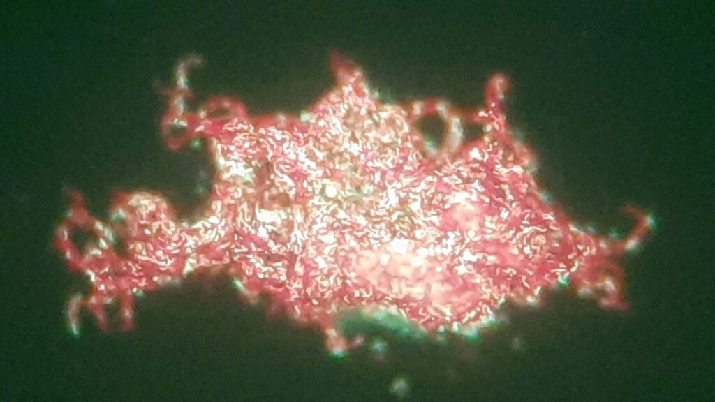Serpentine cord or Cord factor or Trehalose dimycolate (TDM) of Mycobacterium tuberculosis complex (MTBC) in Auramine- Rhodamine staining of modified Middlebrook 7H9 Broth at a magnification of 1600X