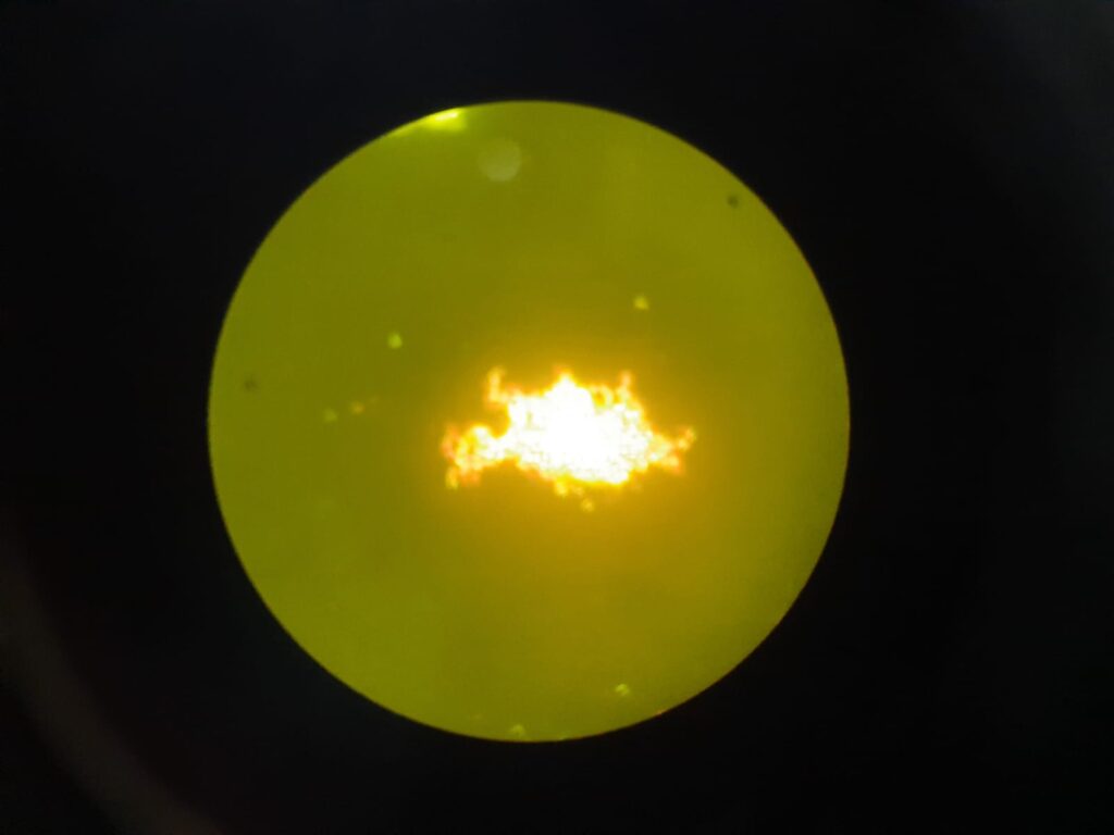 Serpentine cord or Cord factor or Trehalose dimycolate (TDM) of Mycobacterium tuberculosis complex (MTBC) in Auramine- Rhodamine staining of modified Middlebrook 7H9 Broth at a magnification of 400X