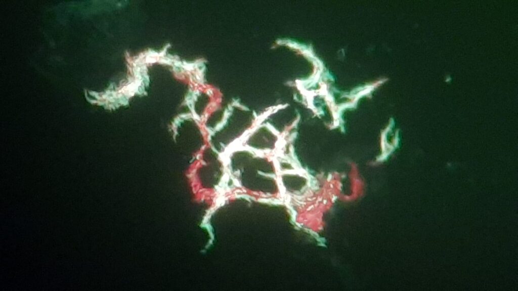 Serpentine cord or cord factor of Mycobacterium tuberculosis (MTB) in liquid culture (Middlebrook medium)