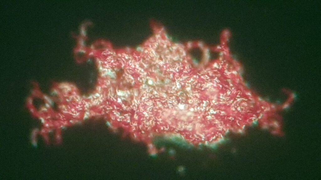 TDM of Mycobacterium tuberculosis complex (MTBC) inAuramine-Rhodamine Fluorochrome Stained smear microscopy of modified Middlebrook 7H9 Broth