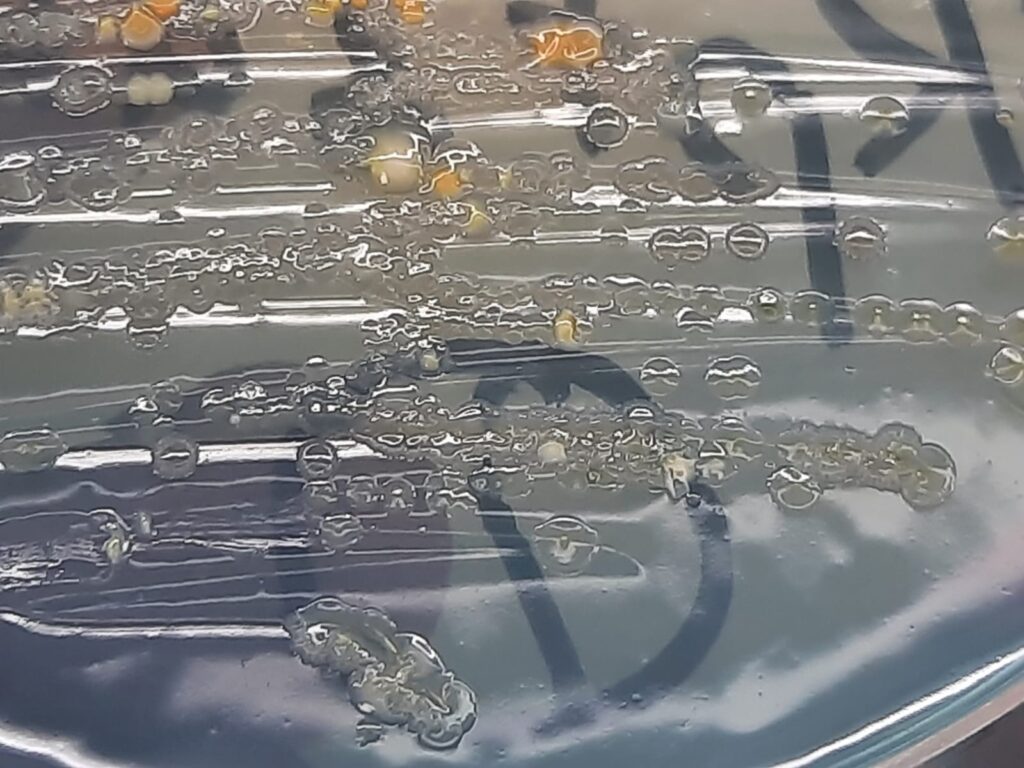 Acinetobacter haemolyticus growth on CLED agar