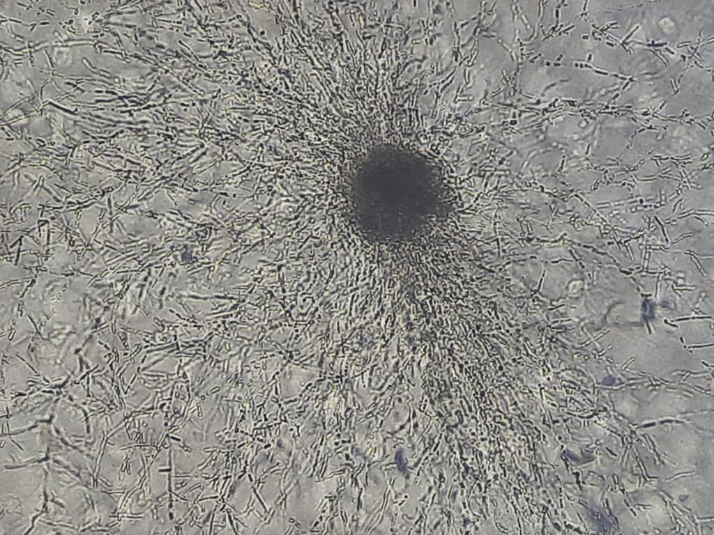 Candida krusei (Pichia kudriavzevii) in Dalmau culture plate microscopic footage at a magnification of 100x with 4x optical enhancement