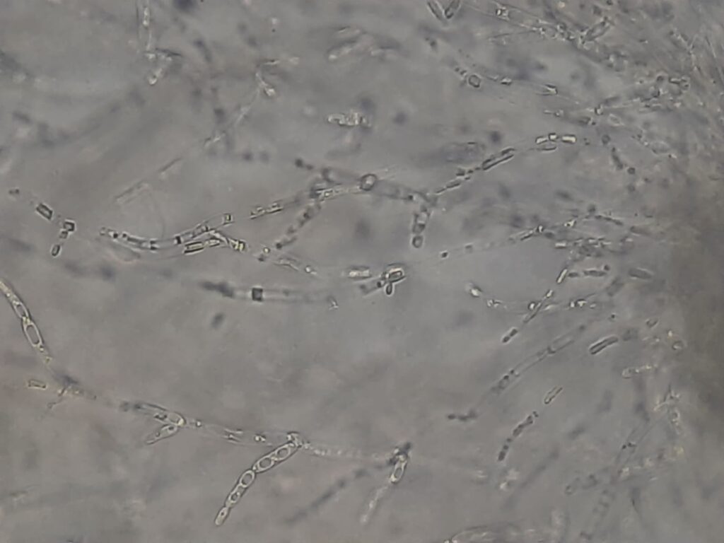 Candida krusei (Pichia kudriavzevii) in Dalmau culture plate microscopic footage at a magnification of 400x with 4x optical enhancement