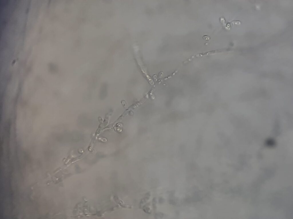 Candida krusei in Dalmau culture plate microscopic footage at a magnification of 400x with 4x optical enhancement