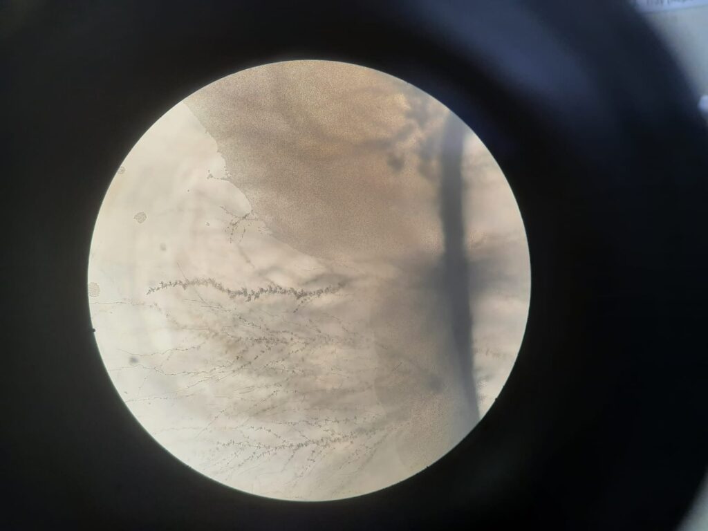 Candida tropicalis in Dalmau culture plate microscopic footage at a magnification of 100x