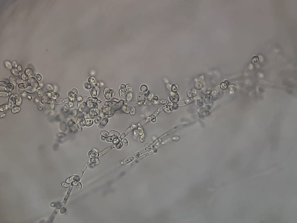 Candida tropicalis in Dalmau culture plate microscopic footage at a magnification of 400x with 4x optical enhancement