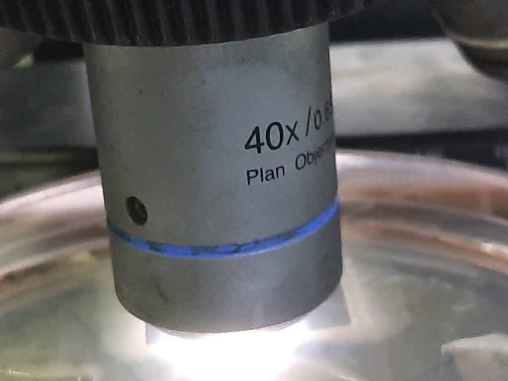 Dalmau Plate Microscopy at high power field (40X objective)