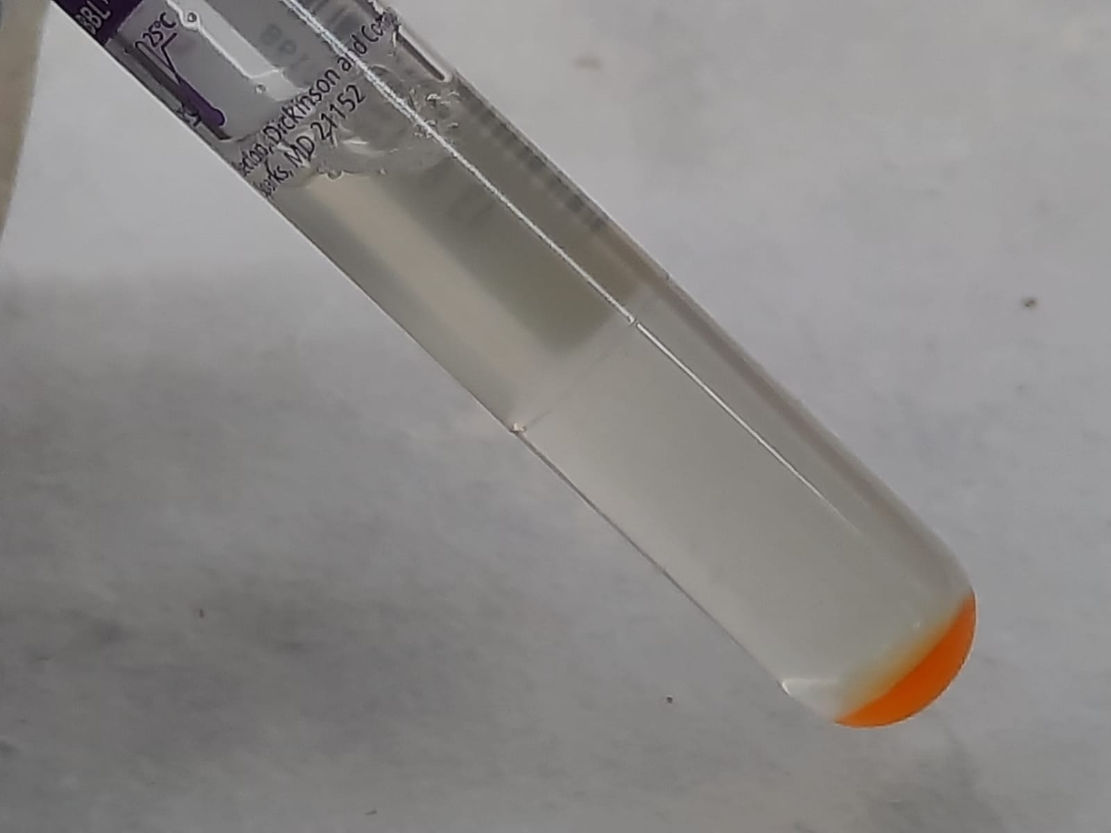 Mycobacterium fortuitum growth on modified Middlebrook 7H9 broth with PANTA supplement after 3 days of incubation