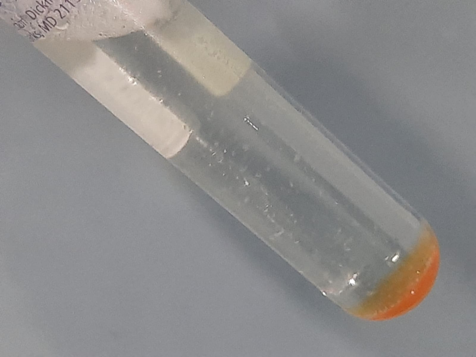 Mycobacterium tuberculosis complex grow on MGIT having modified Middlebrook 7H9 broth with PANTA supplement after 13 days of incubation