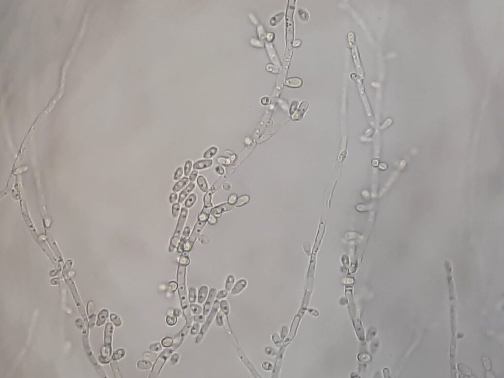 Pichia kudriavzevii (Candida krusei) in Dalmau culture plate microscopic footage at a magnification of 400x with 4x optical enhancement