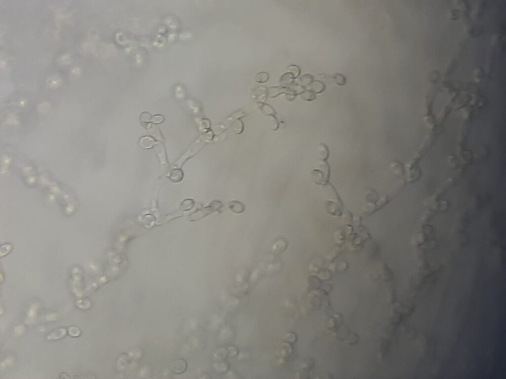 Pichia kudriavzevii(formerly Candida krusei) in Dalmau culture plate microscopic footage at a magnification of 400x with 4x optical enhancement