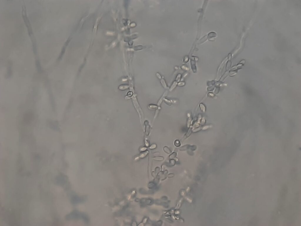 Typical Pichia kudriavzevii( formerly Candida krusei) in Dalmau culture plate microscopic footage at a magnification of 400x with 4x optical enhancement