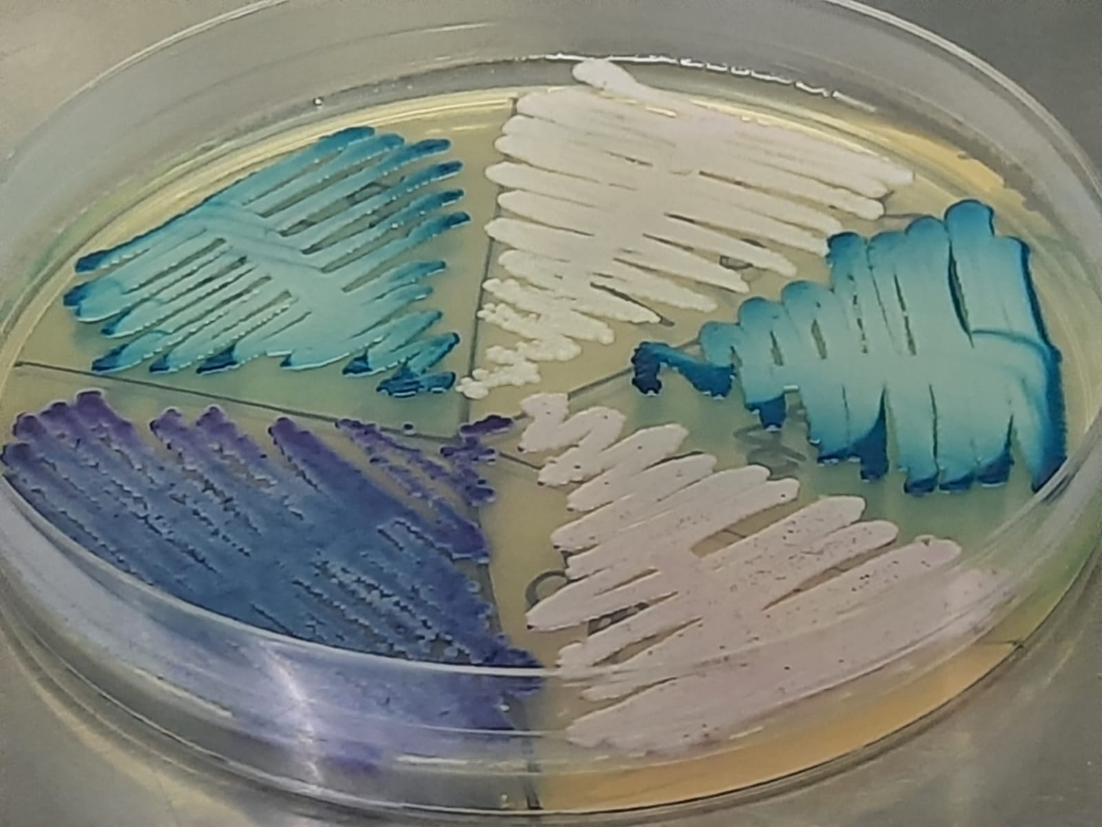 Various Candida species growth on HiCrome Candida Differential Agar after 4 days of incubation