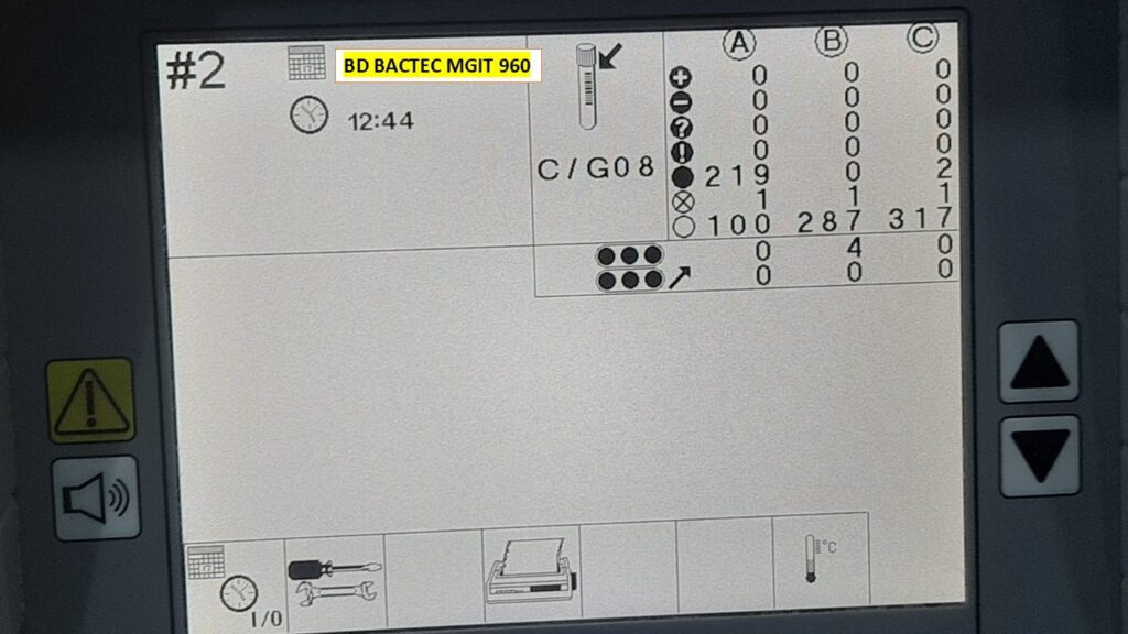 BD BACTEC MGIT 960 instrument display showing the real-time status and distribution of mycobacterial culture tubes