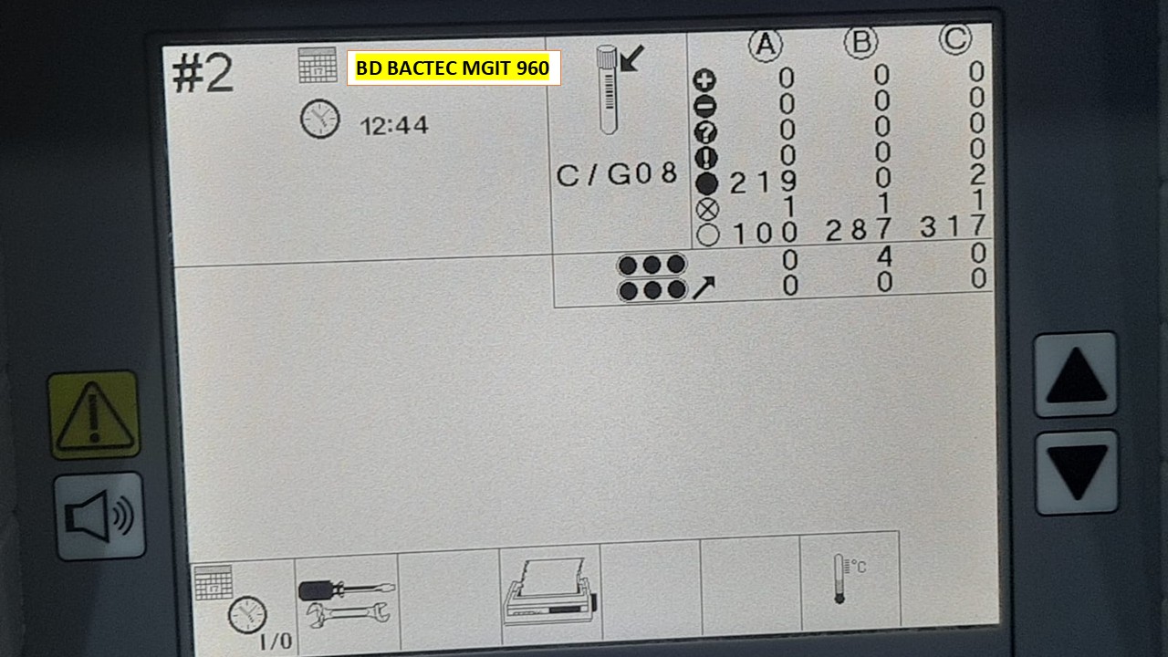 BD BACTEC MGIT 960 instrument display showing the real-time status and distribution of mycobacterial culture tubes
