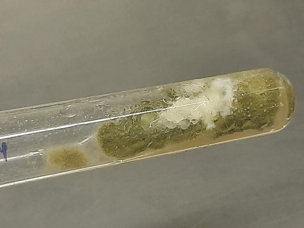 Fungal growth on SDA