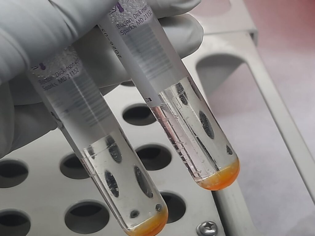 Growth Control (GC)-Left tube-Drug resistant (Lefofloxacin) MTBC-Right tube (Heavy growth)