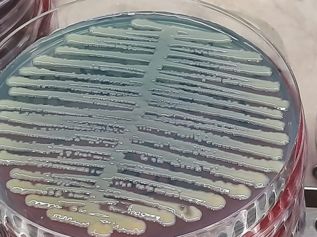 Klebsiella aerogenes colony morphology on CLED agar after 24 hours of incubation