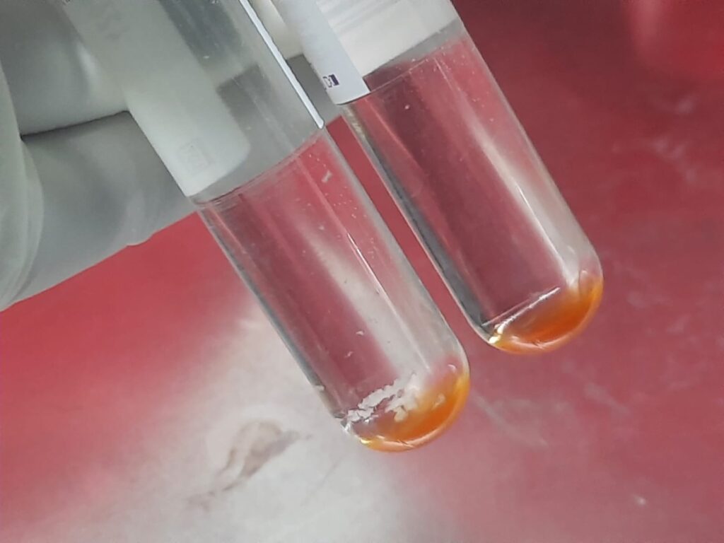Levofloxacin-resistant MTBC-Left tube-Linezolid sensitive MTBC (right tube)