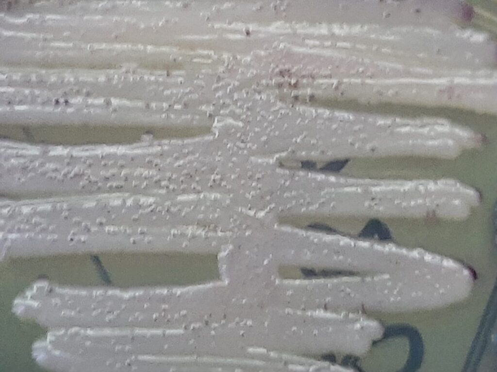 Nakaseomyces glabratus (formerly Candida glabrata) growth on HiCrome Candida Differential Agar