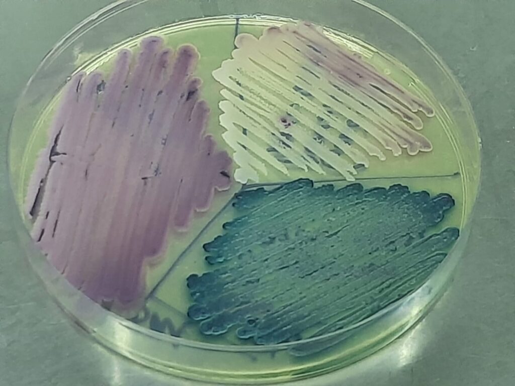 Pichia kudriavzevii, Candida albicans and Candida parasilosis growth on HiCrome Candida Differential Agar
