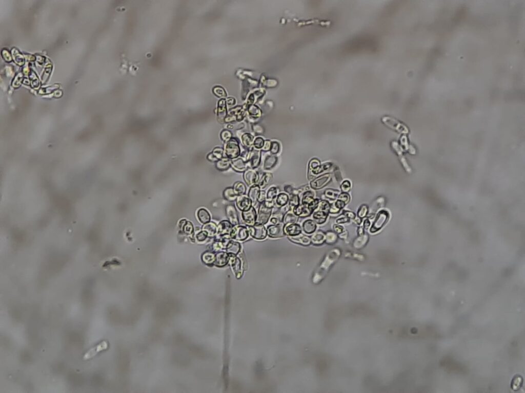 Pichia kudriavzevii in Germ tube test