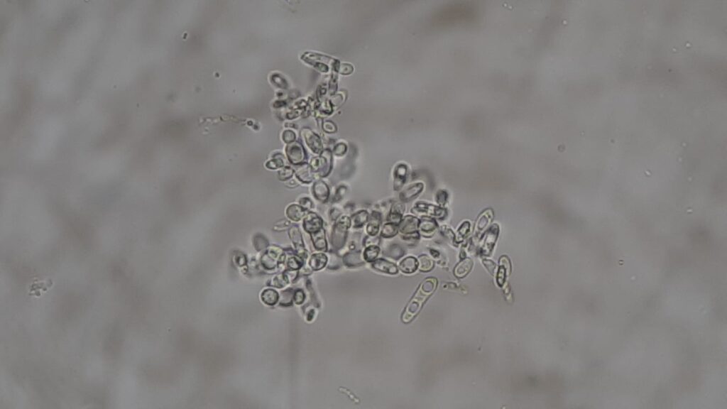 Pichia kudriavzevii structures in wet mount of Germ tube test