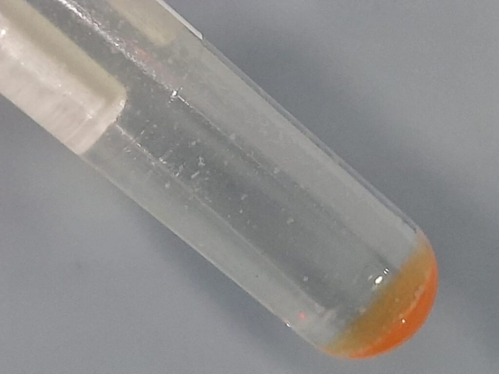 Positive MGIT liquid culture of sputum after mixing, showing turbidity indicative of mycobacterial growth in the presence of PANTA supplement.