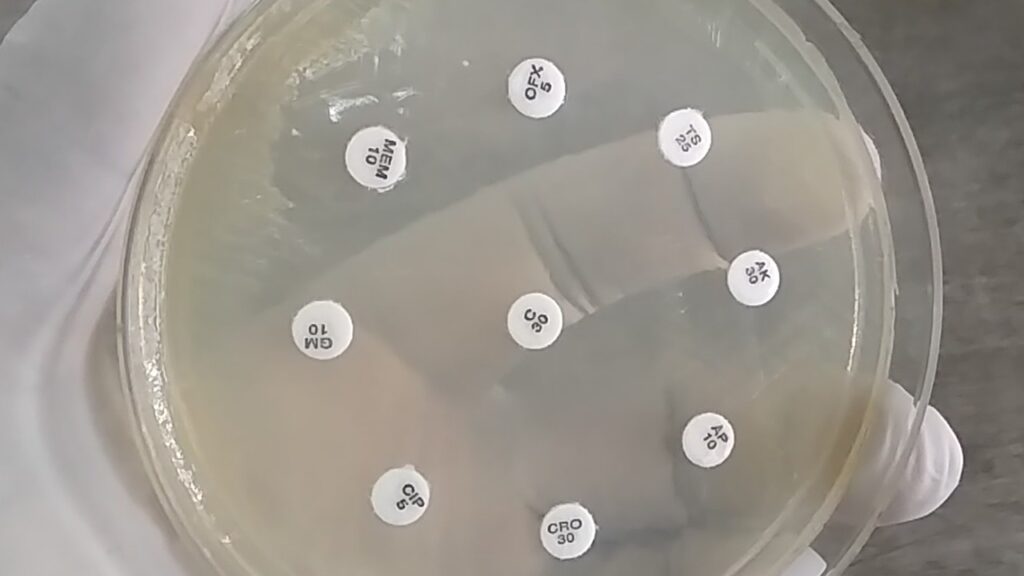 Alcaligenes faecalis Antimicrobial Susceptibility Testing (AST) Result