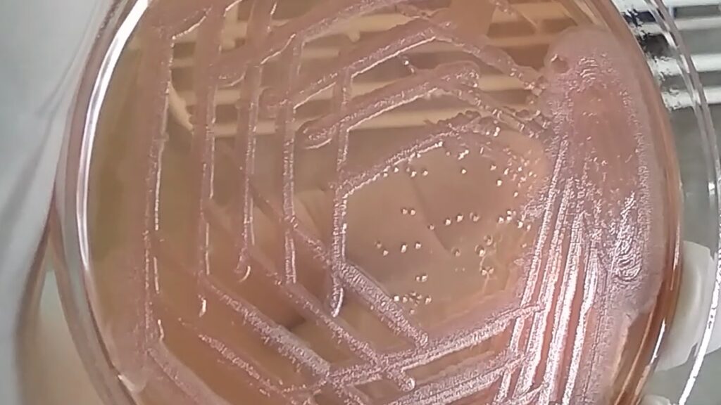 Alcaligenes faecalis growth on MacConkey agar