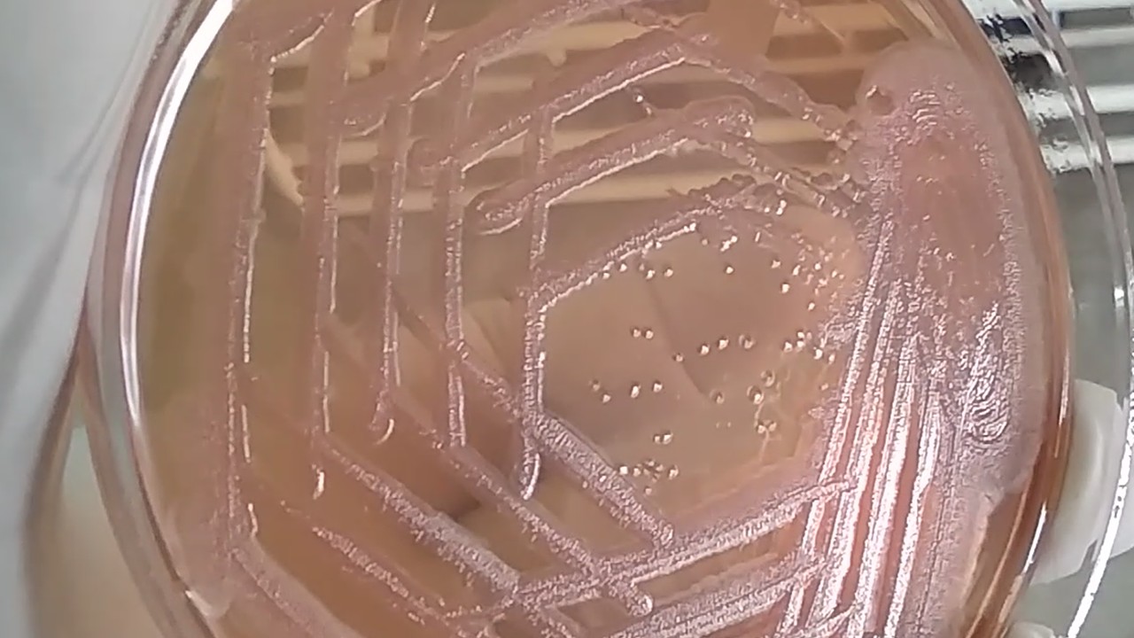 Alcaligenes faecalis growth on MacConkey agar