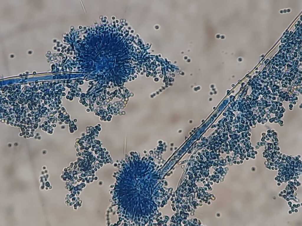  Aspergillus terreus in LPCB tease mount showing columnar conidial heads, biseriate vesicles, and smooth-walled conidiophores at a high magnification of 40OX with extra 4X optical zoom