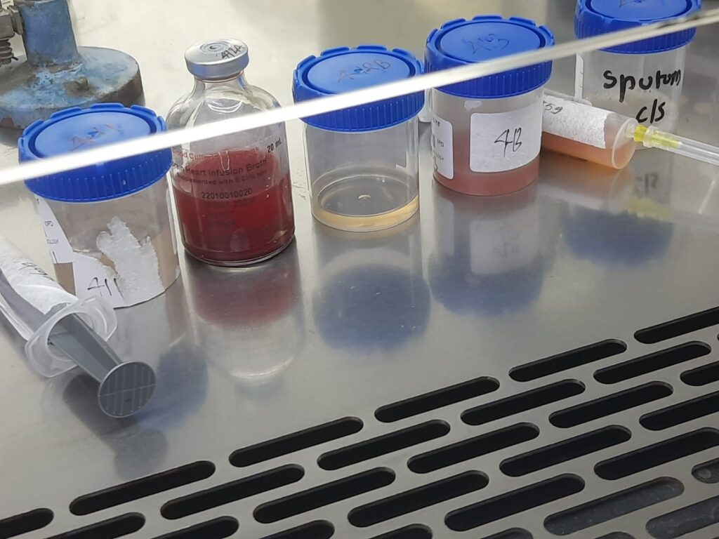 Clinical specimen preparation process within a Biosafety Cabinet (BSC) prior to culture following Safe Handling & Inoculation in a Class II BSC