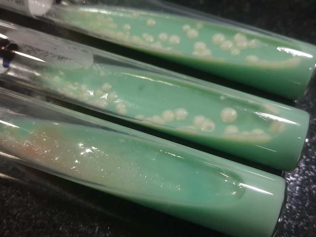 Early-Stage Contamination on Lowenstein-Jensen (L-J) Media: Observation-Presence of multiple smooth, moist, circular colonies on the slant surface. Contrasting Morphology- These colonies lack the typical "buff, rough, and tough" dry appearance of Mycobacterium tuberculosis. Identification Clue-The rapid appearance of these distinct colonies (often within 48–72 hours) indicates the presence of faster-growing bacteria or yeasts, such as Candida species or Gram-positive cocci.